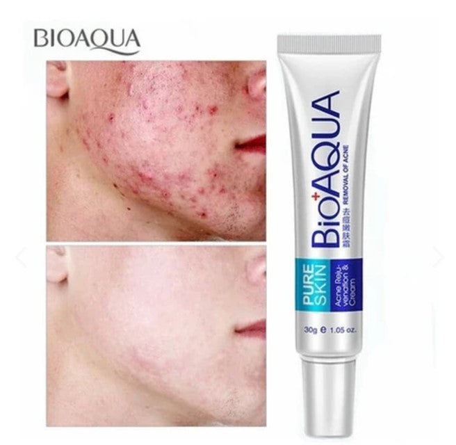 Crema Antiacné Espinilla Bioaqua